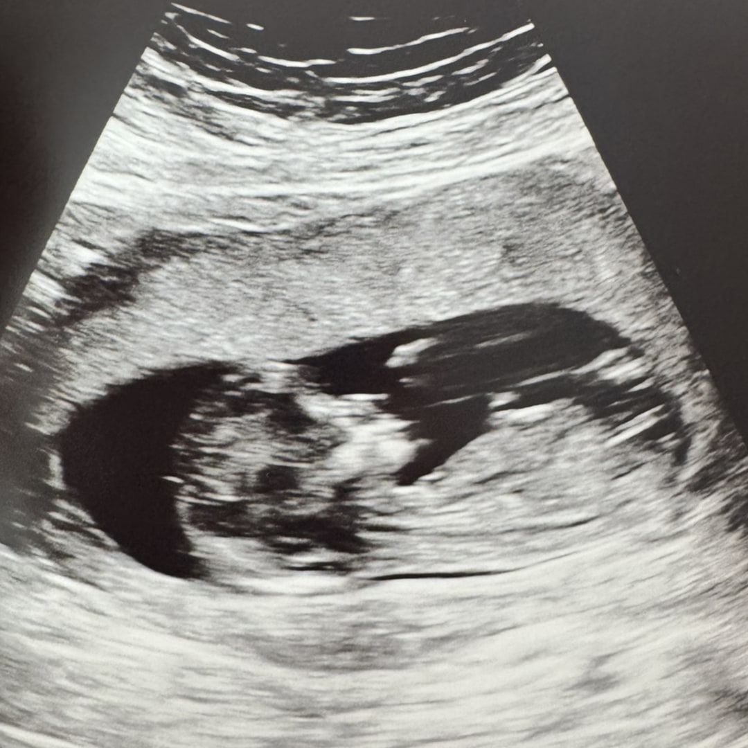 Photo shared by Marina for their Babylist baby registry.