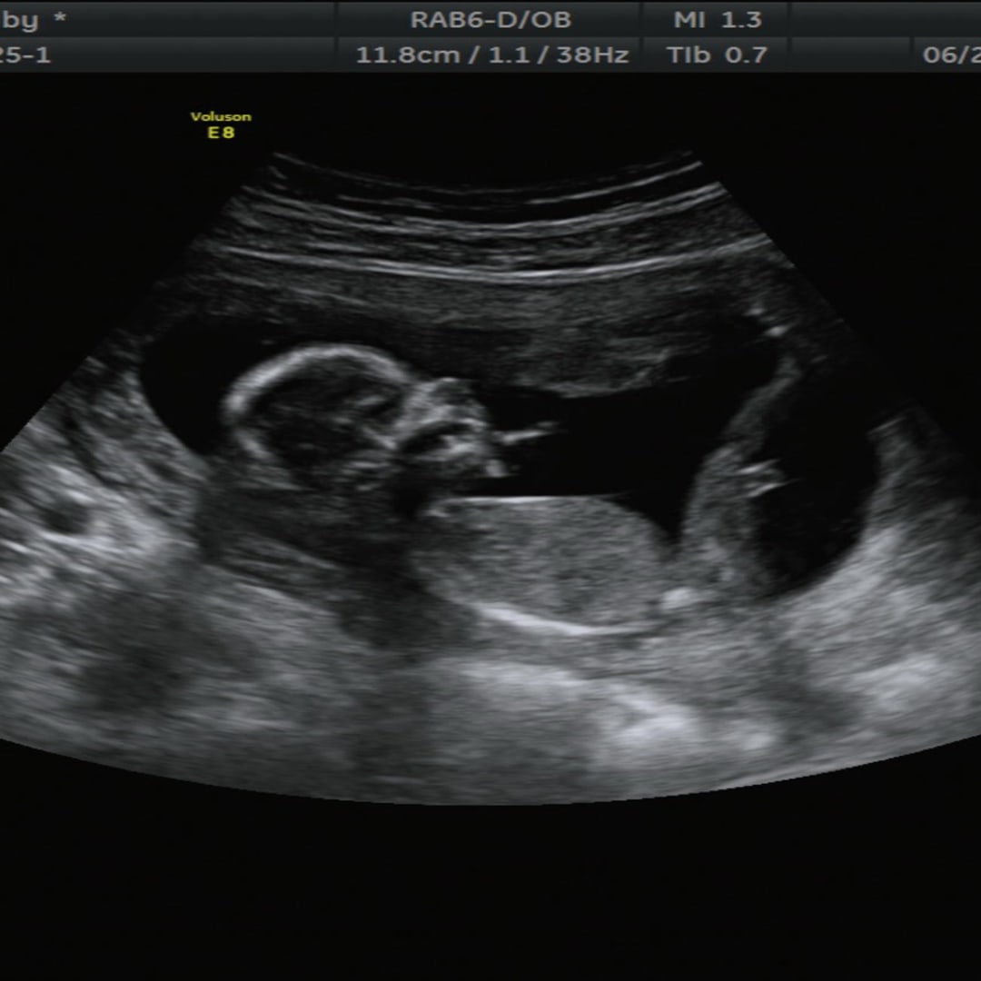 Photo shared by Bri for their Babylist baby registry.