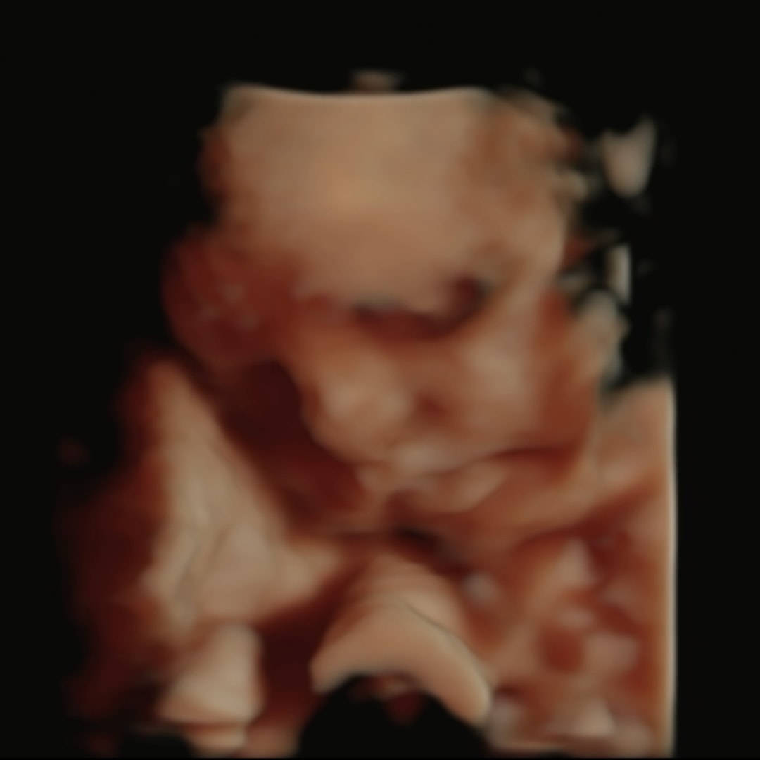 Photo shared by Brooklynn for their Babylist baby registry.