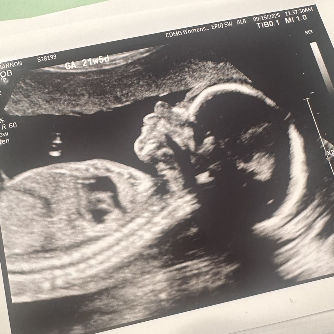 Photo shared by Shannon for their Babylist baby registry.