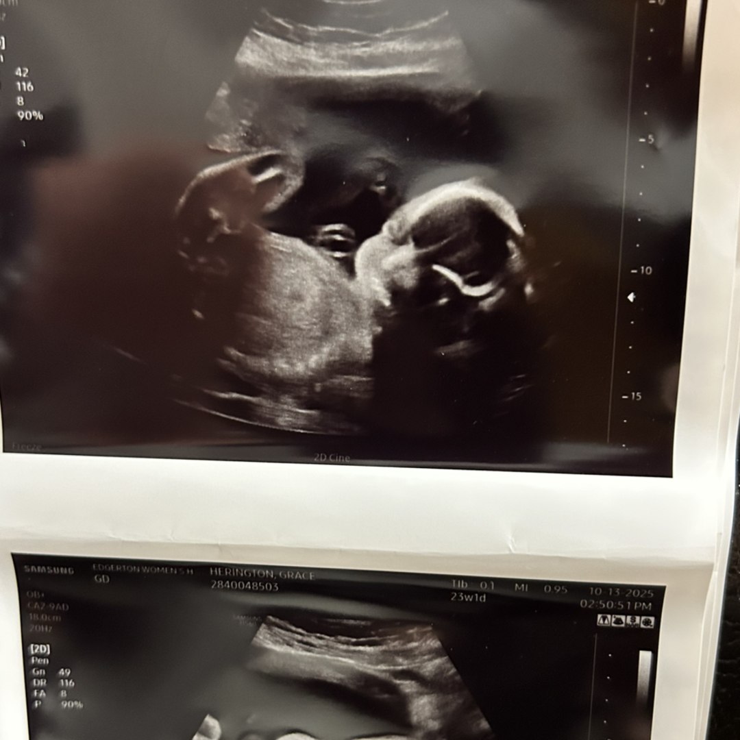 Photo shared by Grace for their Babylist baby registry.