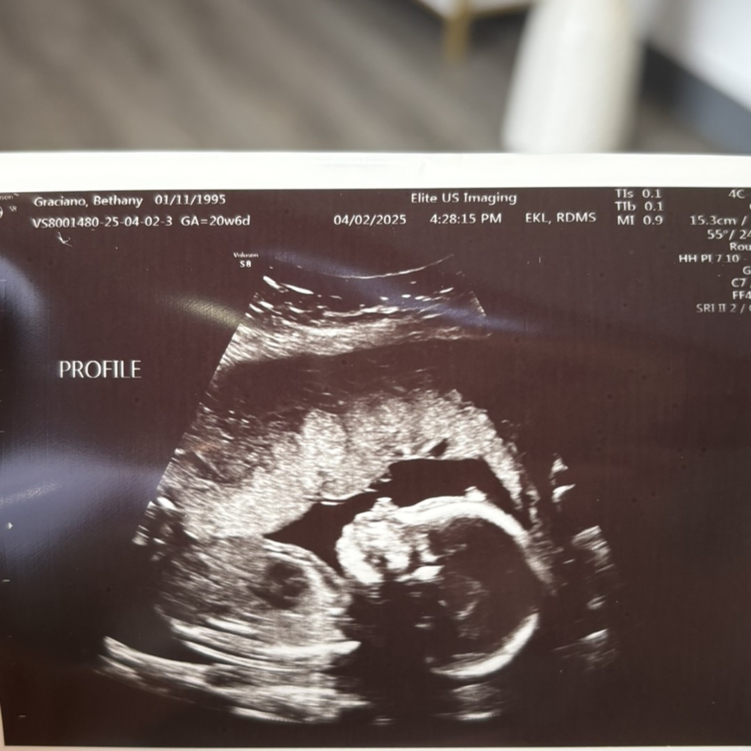 Photo shared by Bethany for their Babylist baby registry.