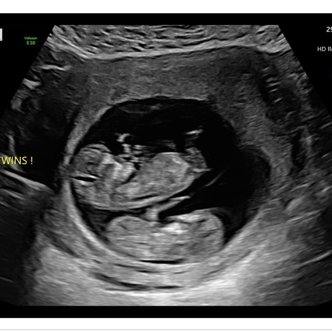 Photo shared by Reagan for their Babylist baby registry.