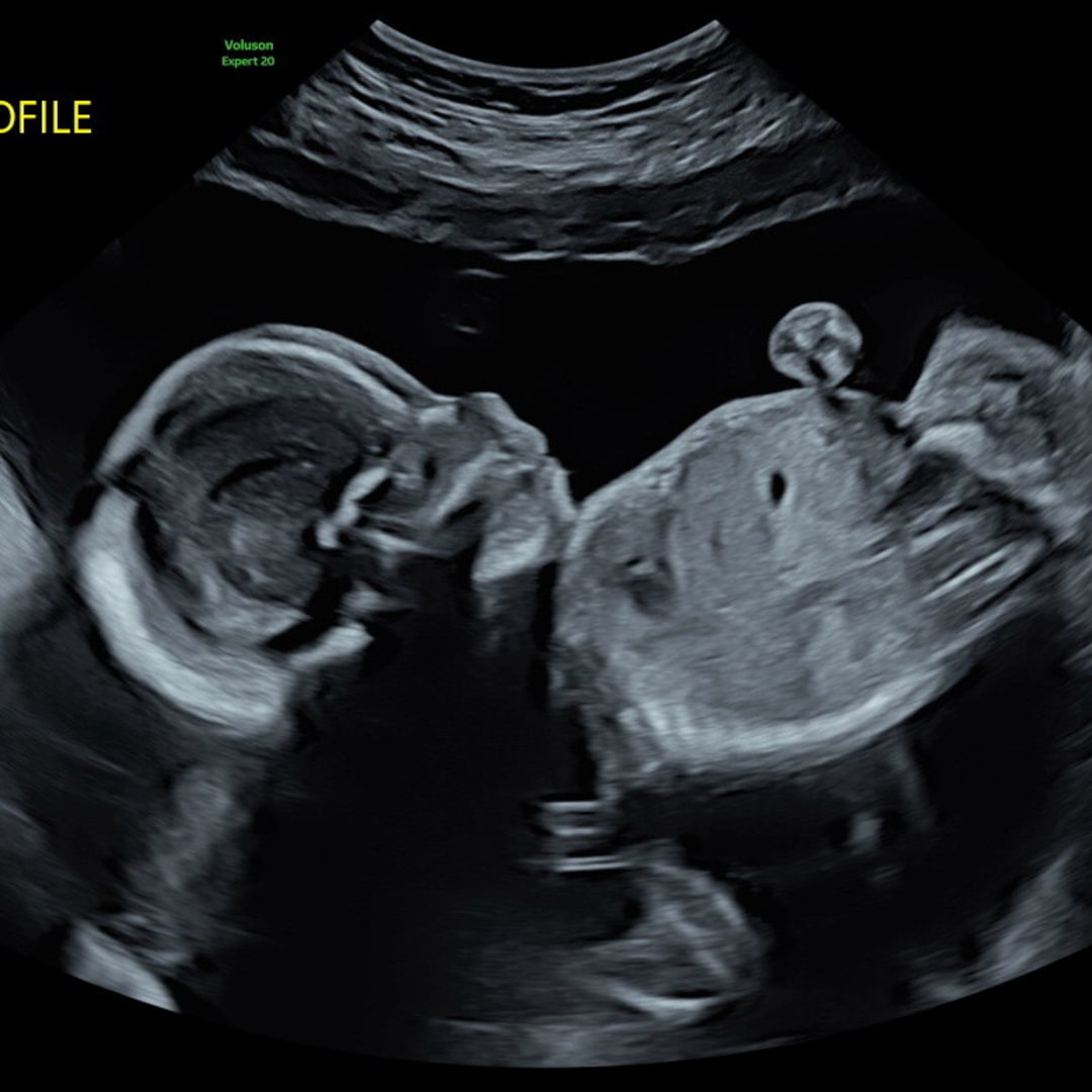 Photo shared by Hawley for their Babylist baby registry.