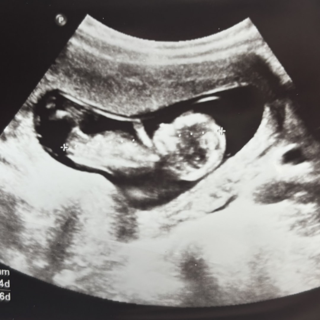 Photo shared by Faith for their Babylist baby registry.