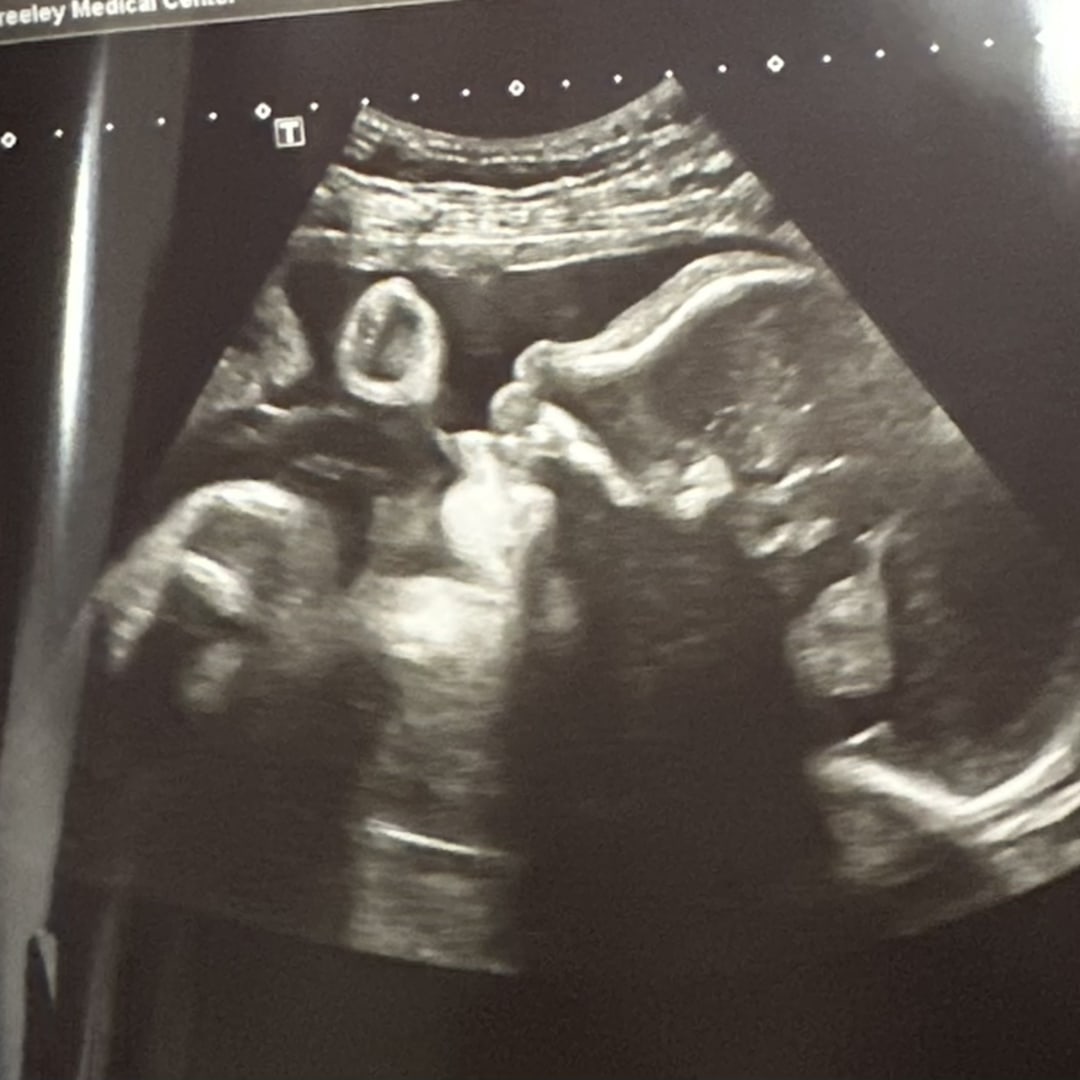 Photo shared by Ivette for their Babylist baby registry.