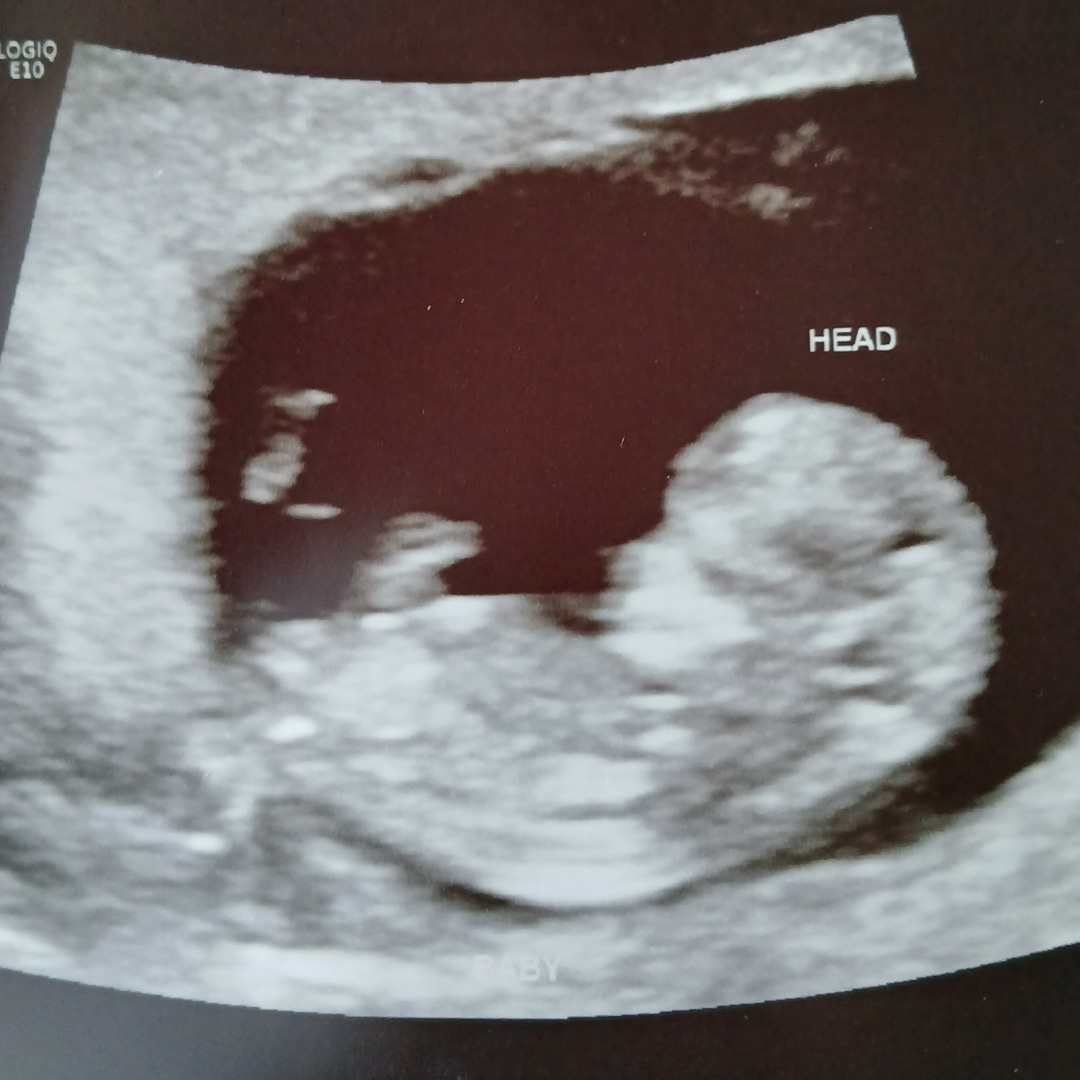 Photo shared by Audra for their Babylist baby registry.