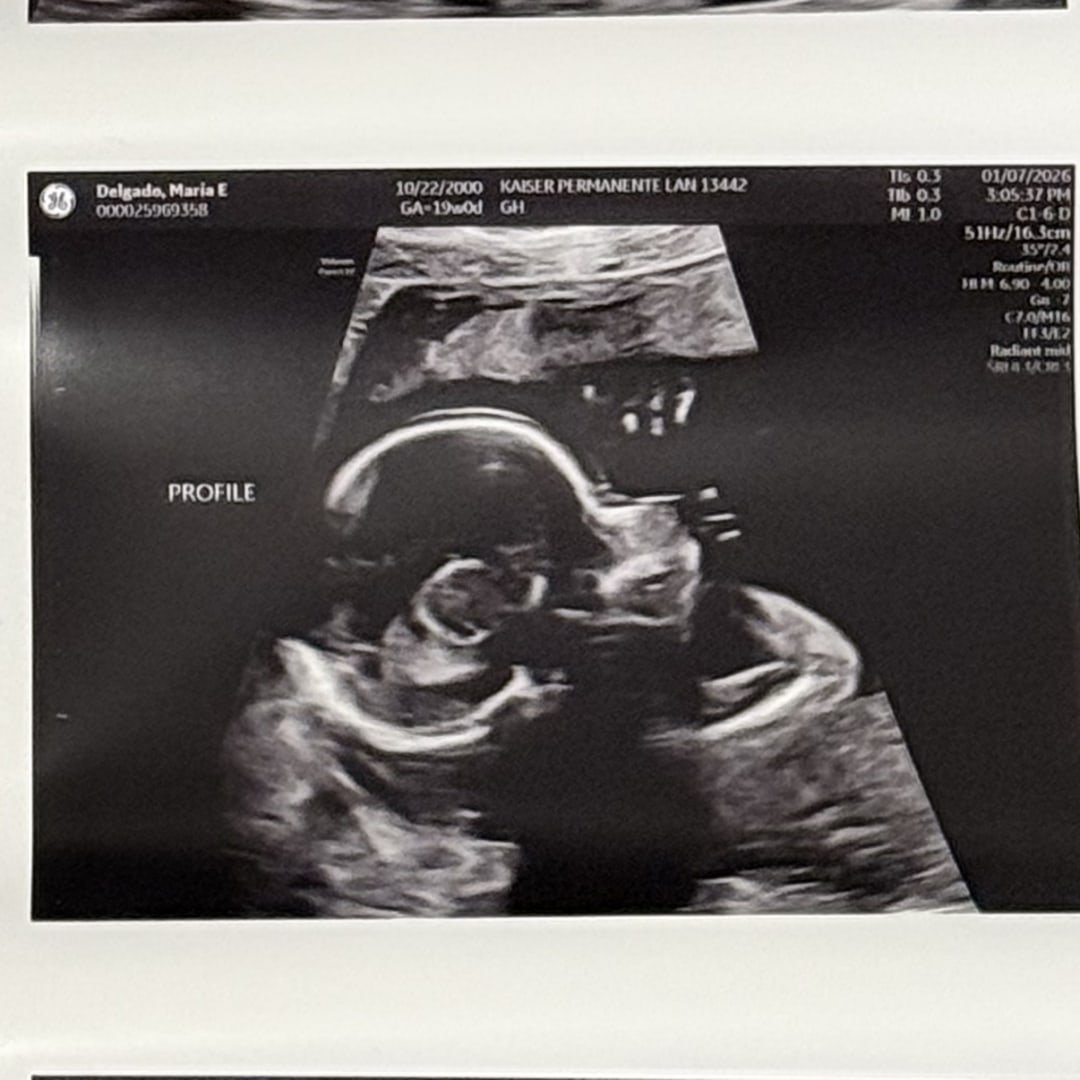 Photo shared by Elena for their Babylist baby registry.