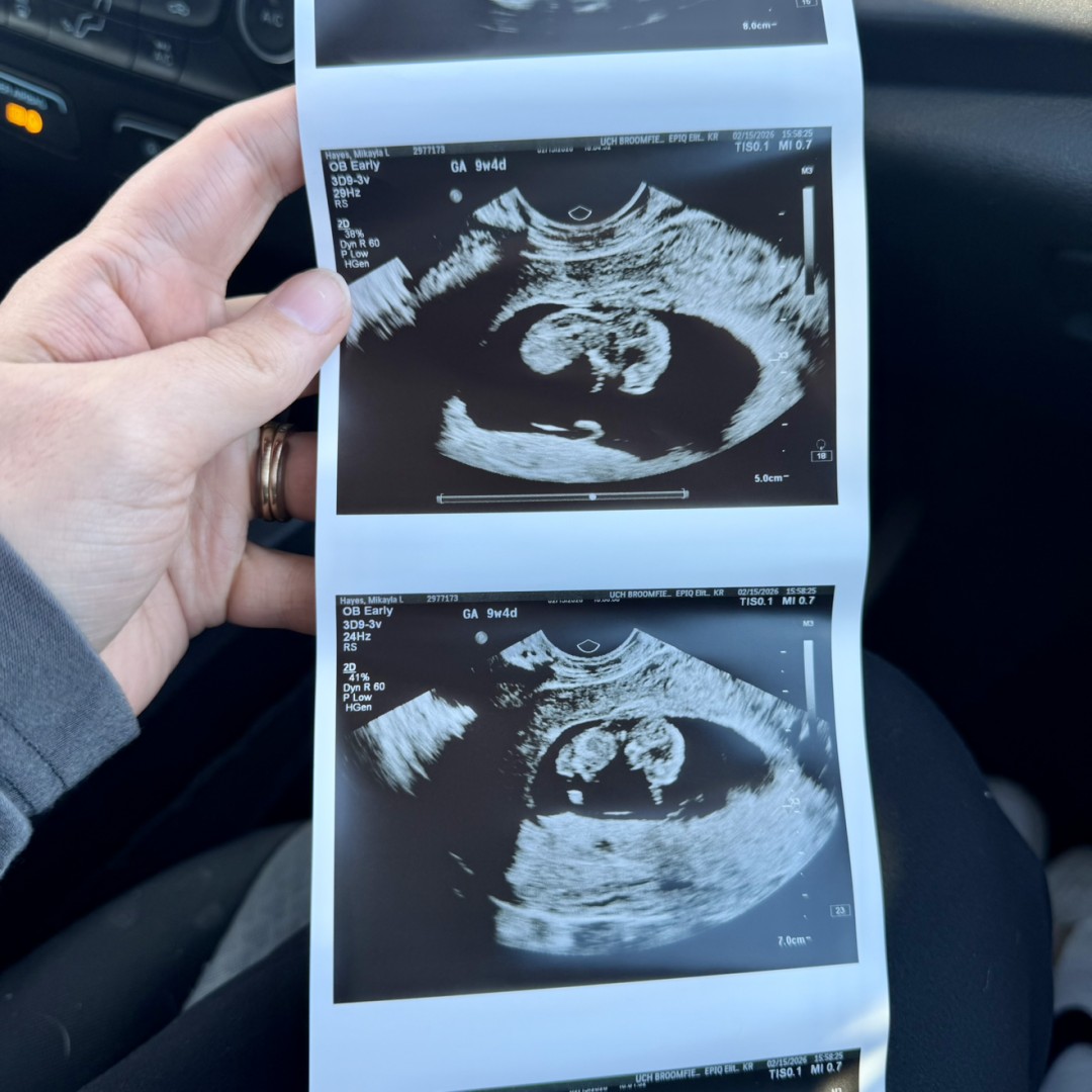Photo shared by Mikayla for their Babylist baby registry.