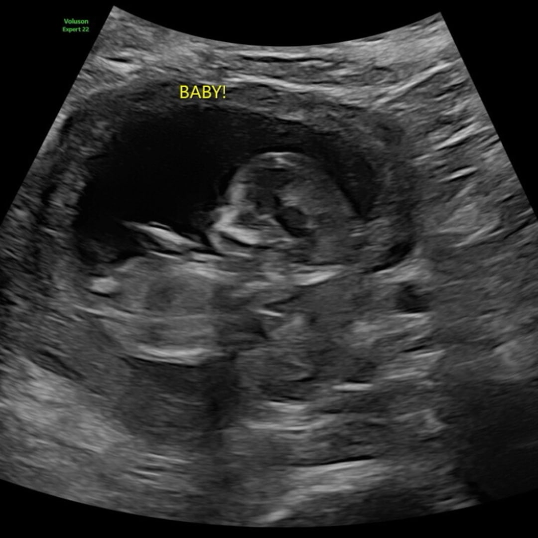 Photo shared by Abby for their Babylist baby registry.