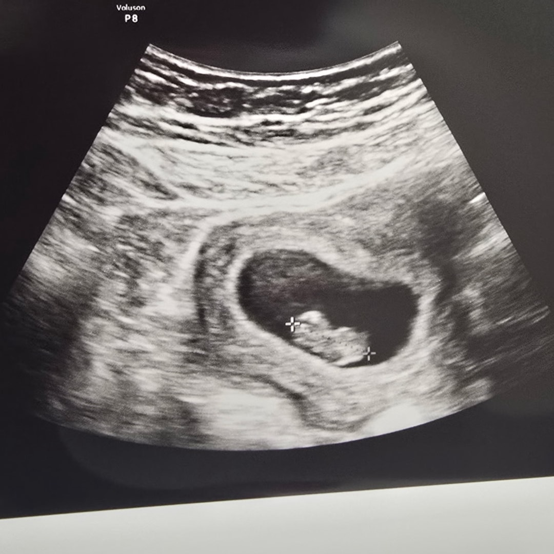 Photo shared by Anya for their Babylist baby registry.