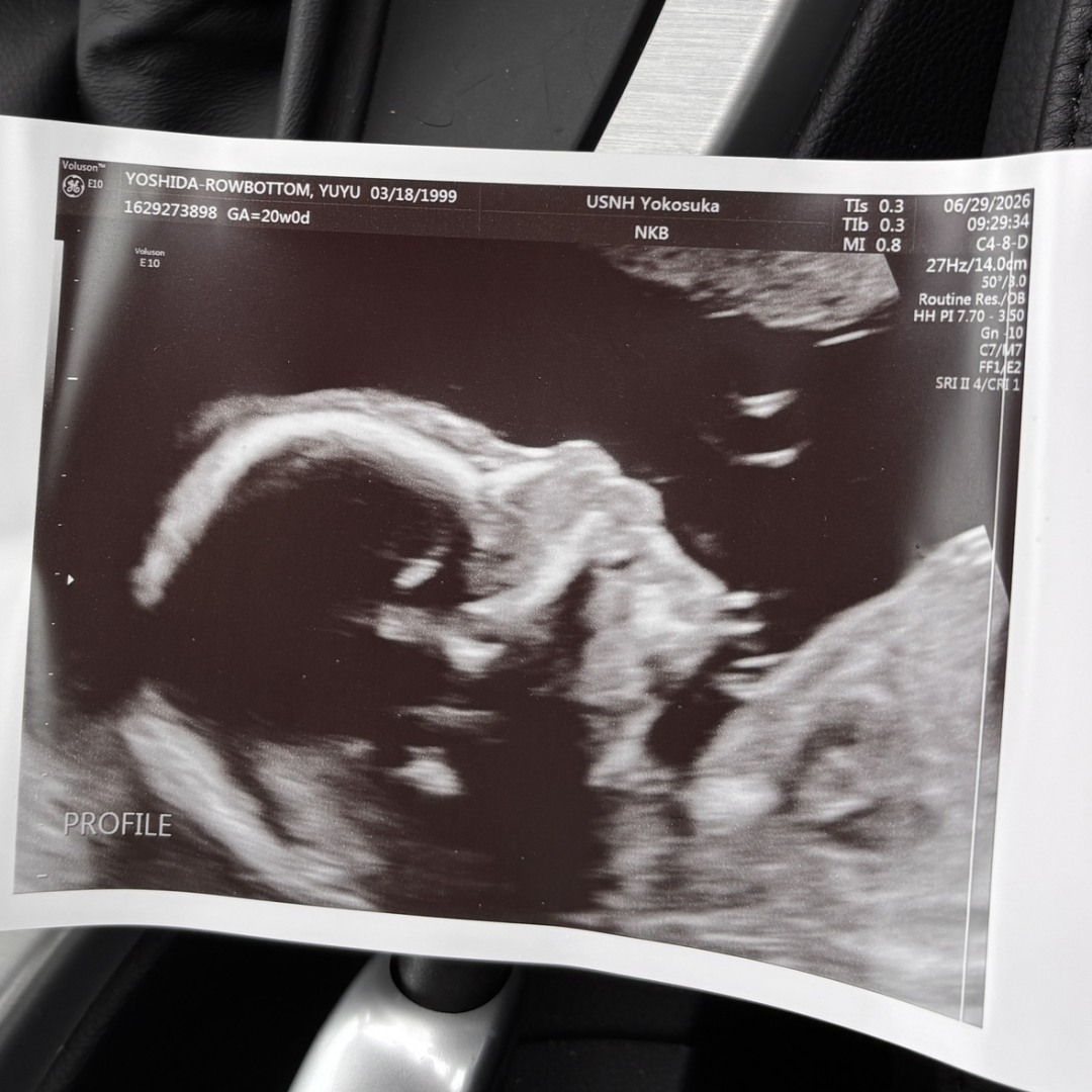 Photo shared by Yuyu for their Babylist baby registry.