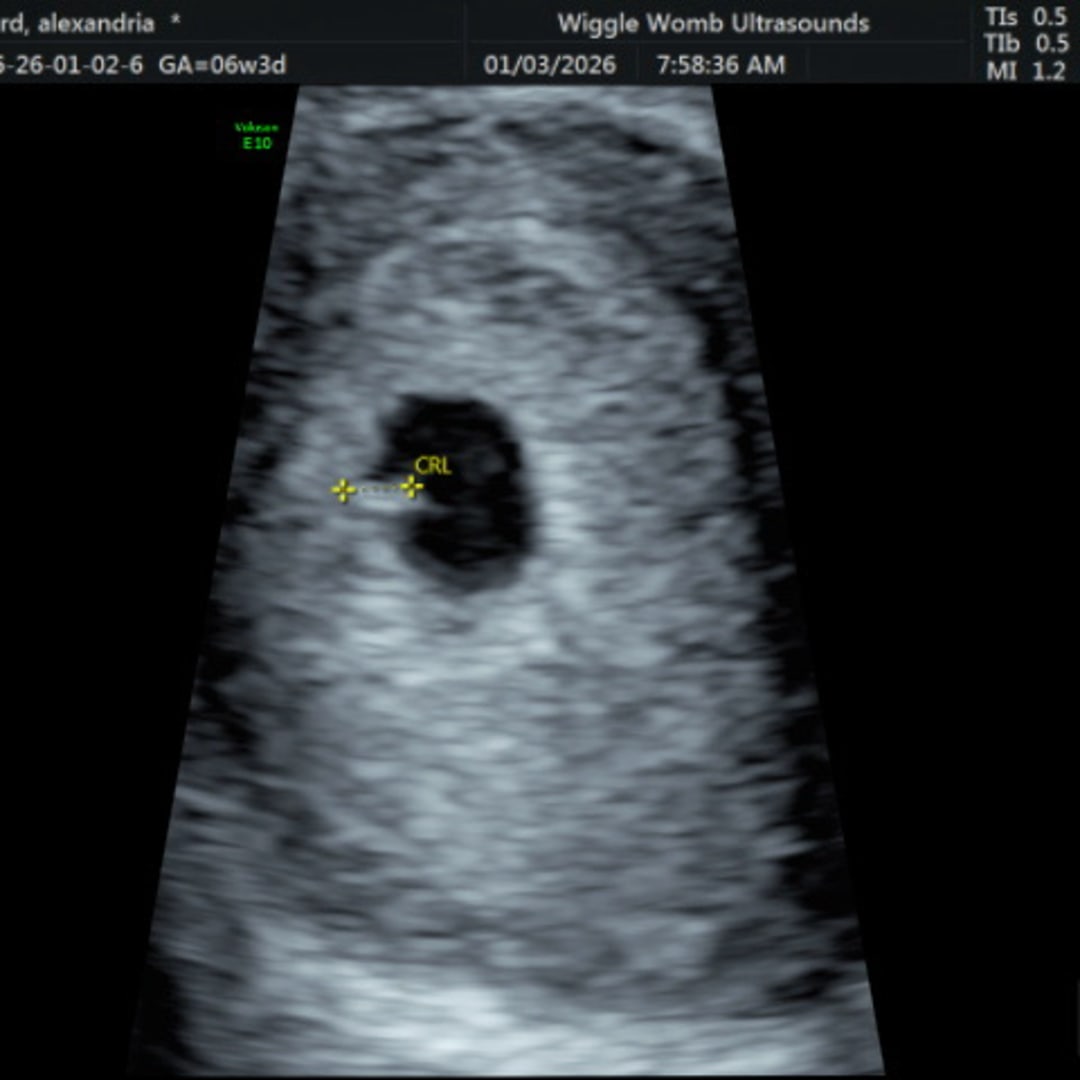 Photo shared by Alex for their Babylist baby registry.