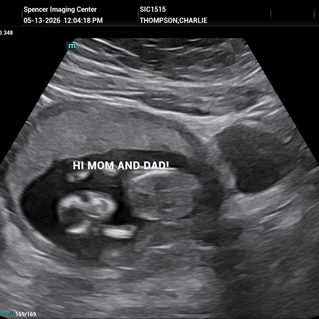 Photo shared by Charolette for their Babylist baby registry.