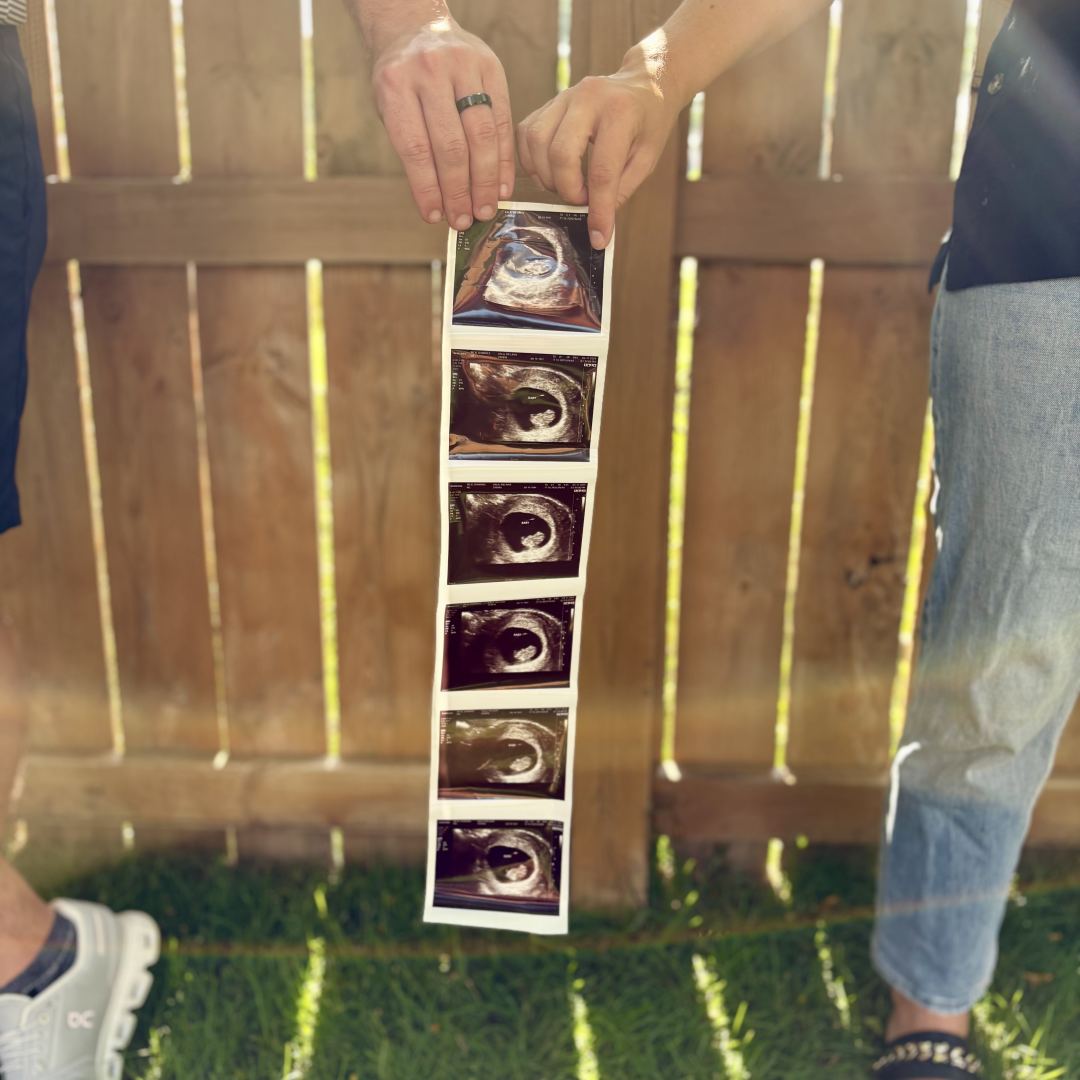 Photo shared by Melanie for their Babylist baby registry.