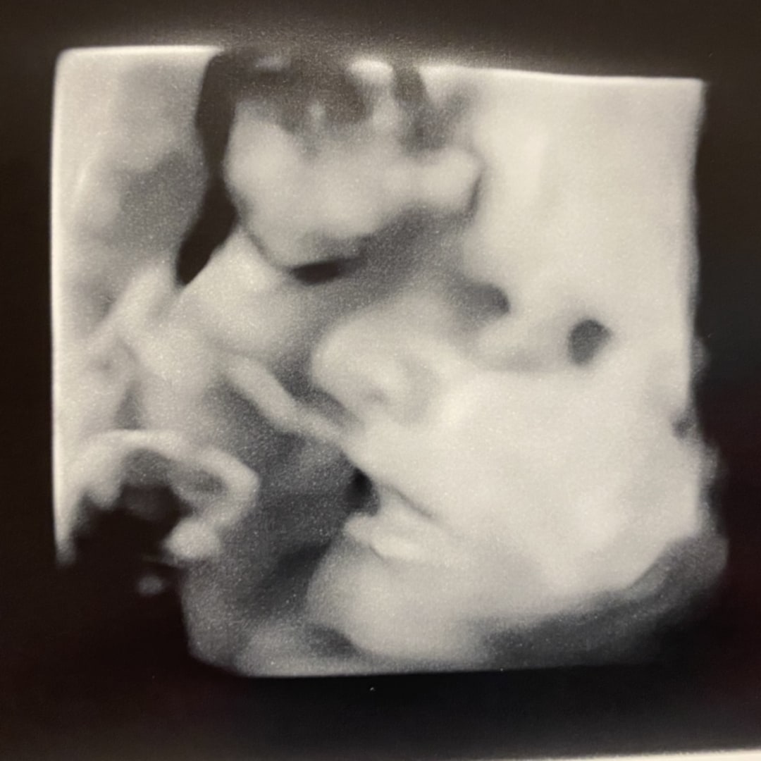 Photo shared by Tesia for their Babylist baby registry.
