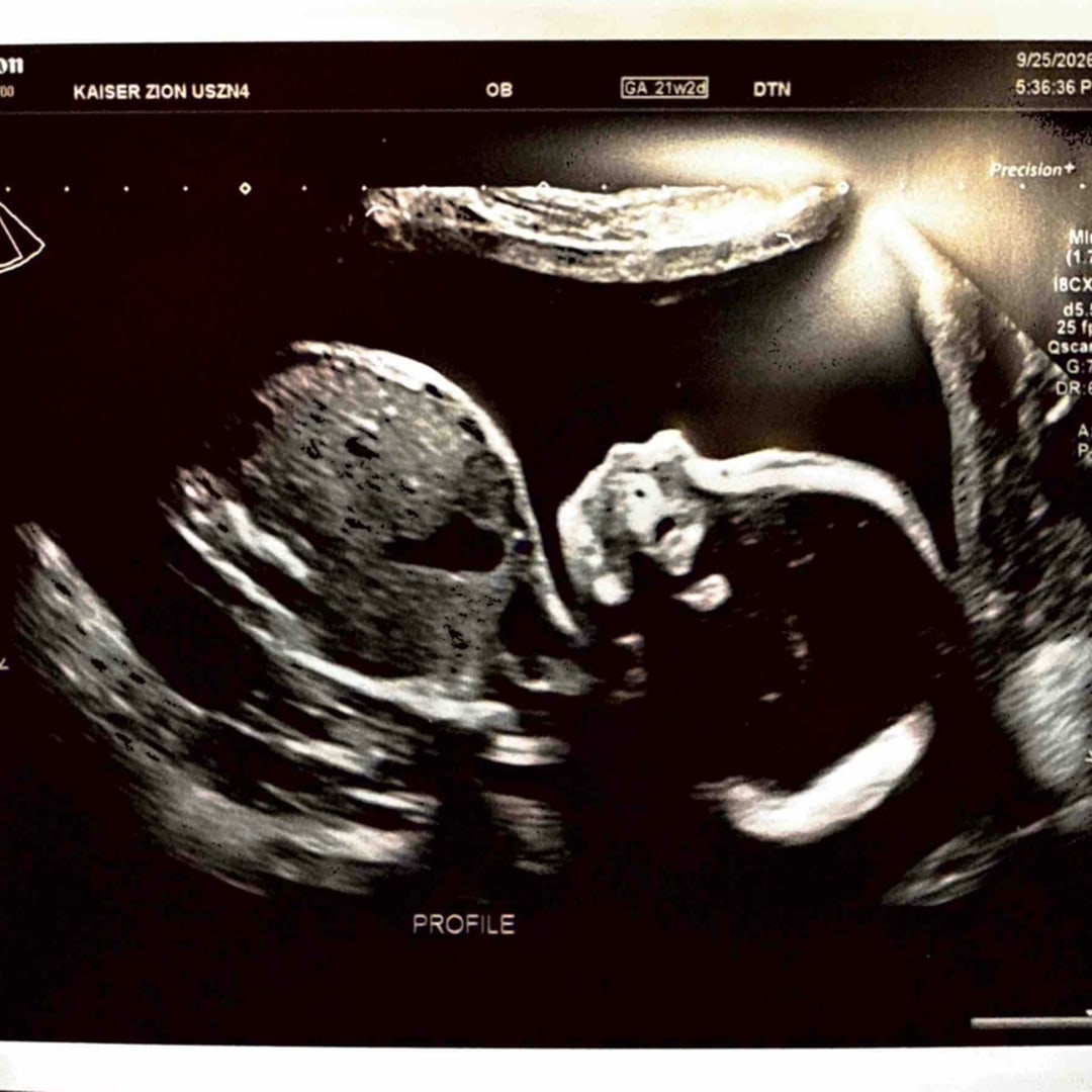 Photo shared by Brittany for their Babylist baby registry.