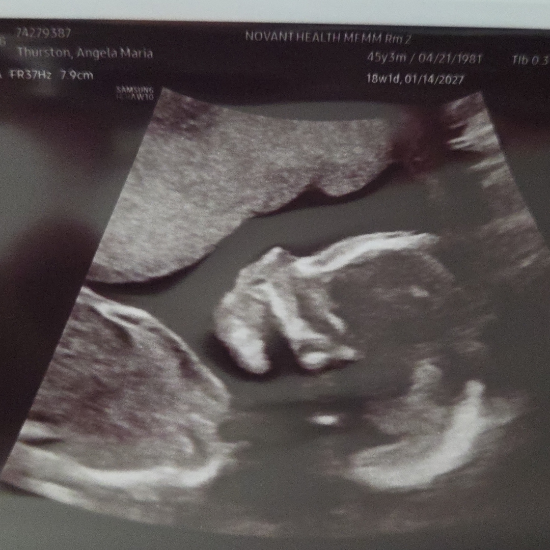 Photo shared by Angela for their Babylist baby registry.