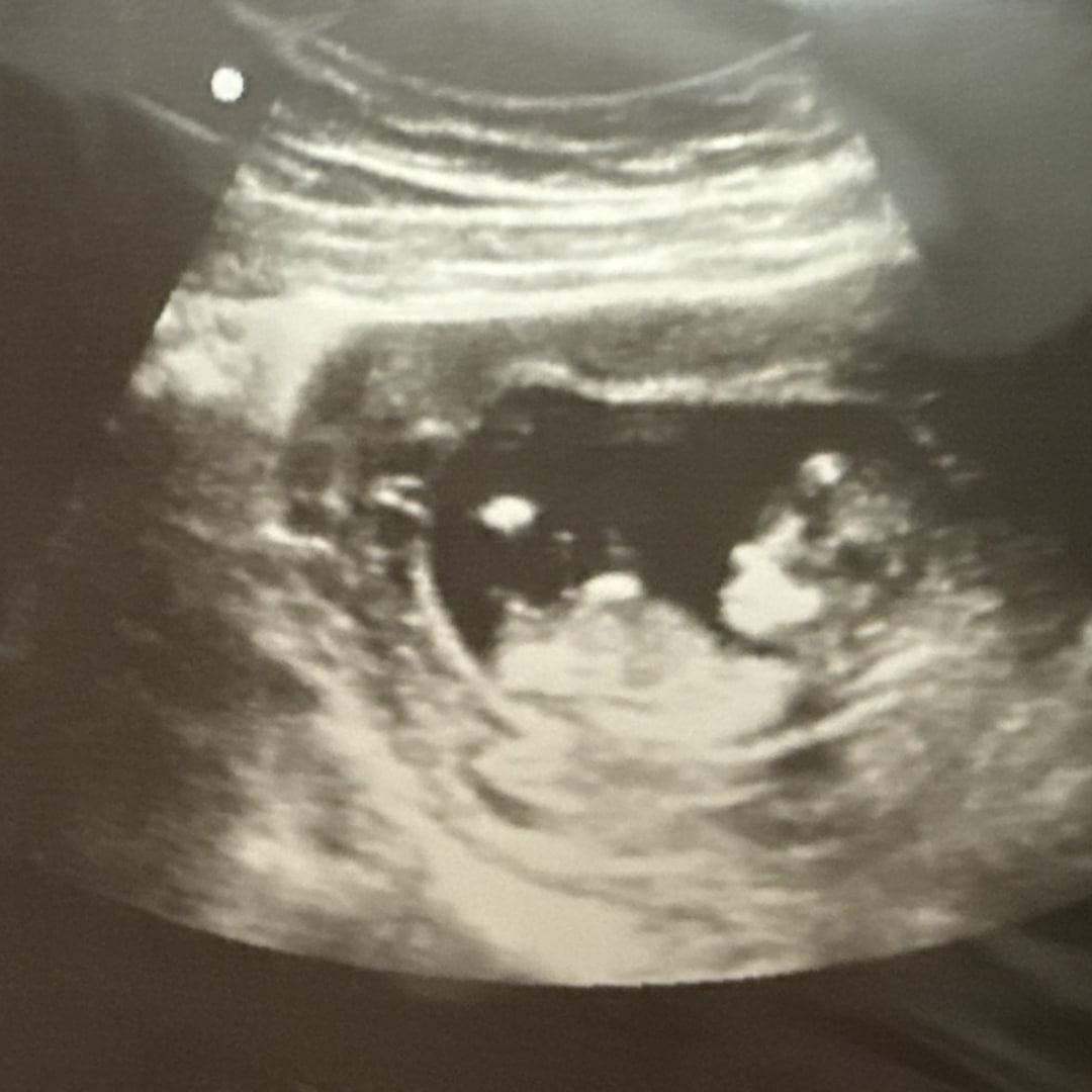 Photo shared by Chelsie for their Babylist baby registry.