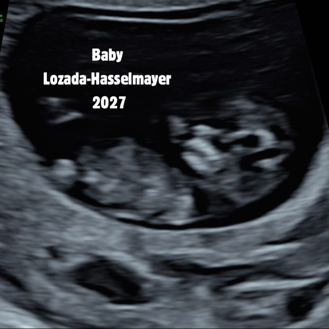 Photo shared by Elizabeth for their Babylist baby registry.