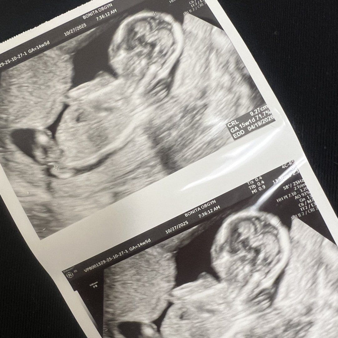 Photo shared by Stephanie for their Babylist baby registry.