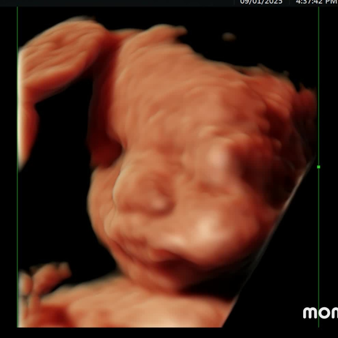 Photo shared by Melissa for their Babylist baby registry.