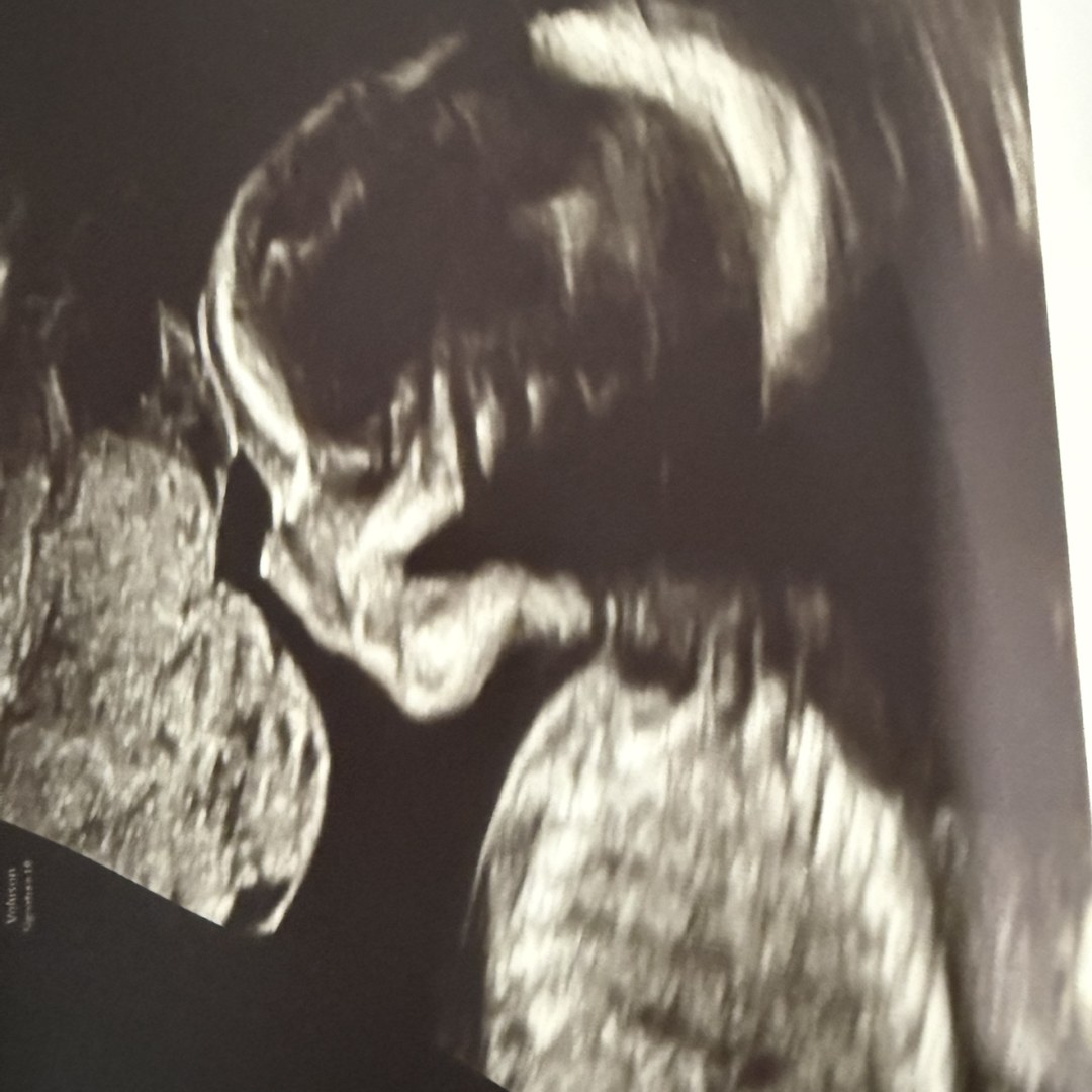Photo shared by Shawna for their Babylist baby registry.