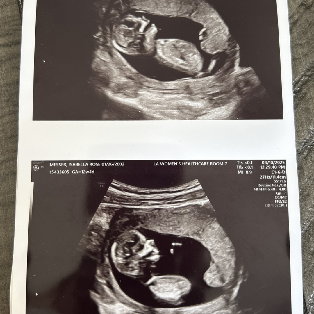 Photo shared by Isabella for their Babylist baby registry.