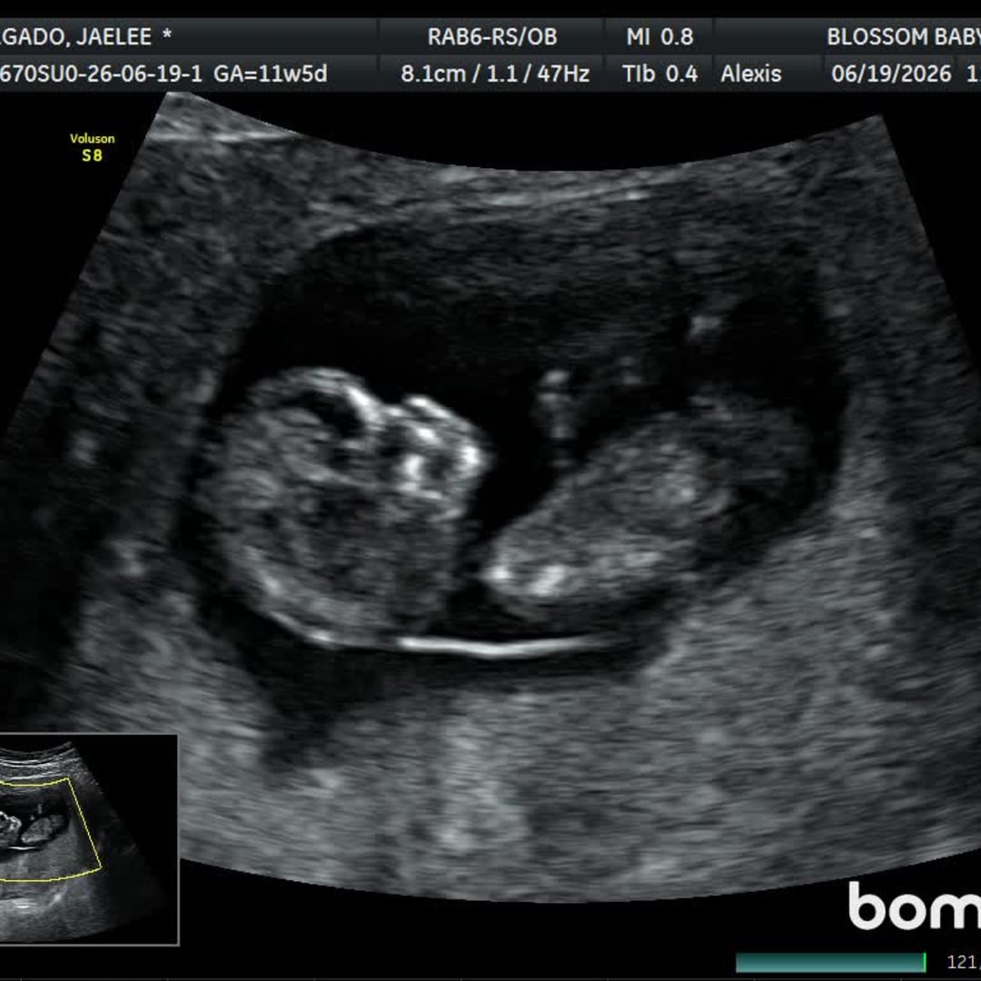 Photo shared by Jaelee for their Babylist baby registry.