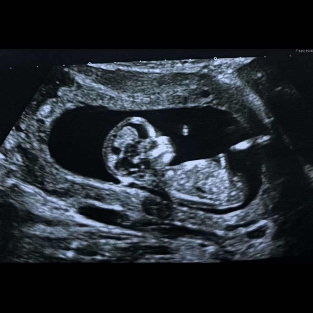 Photo shared by Lizbeth for their Babylist baby registry.