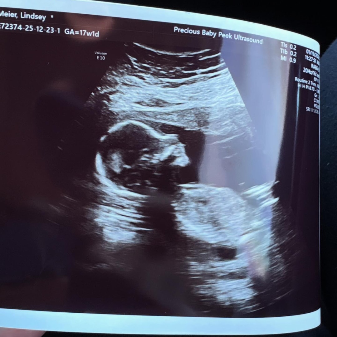 Photo shared by Lindsey for their Babylist baby registry.