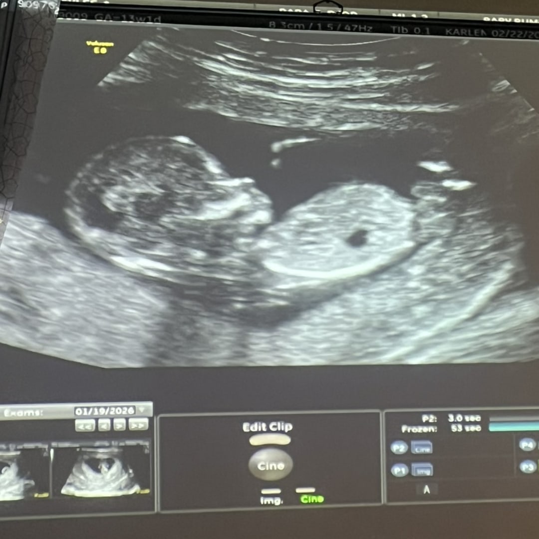 Photo shared by Kaylee for their Babylist baby registry.