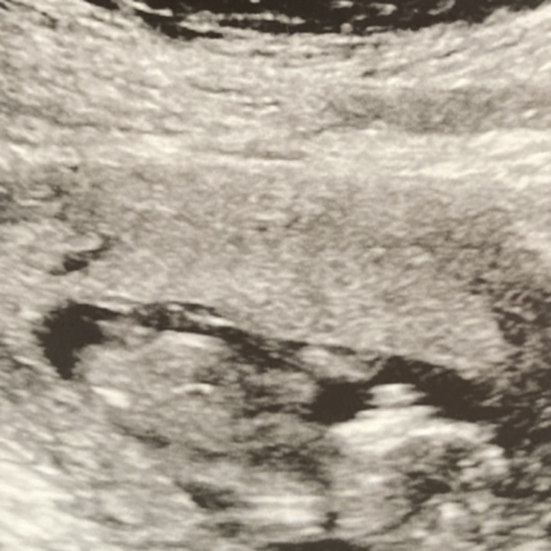 Photo shared by Kiersten for their Babylist baby registry.
