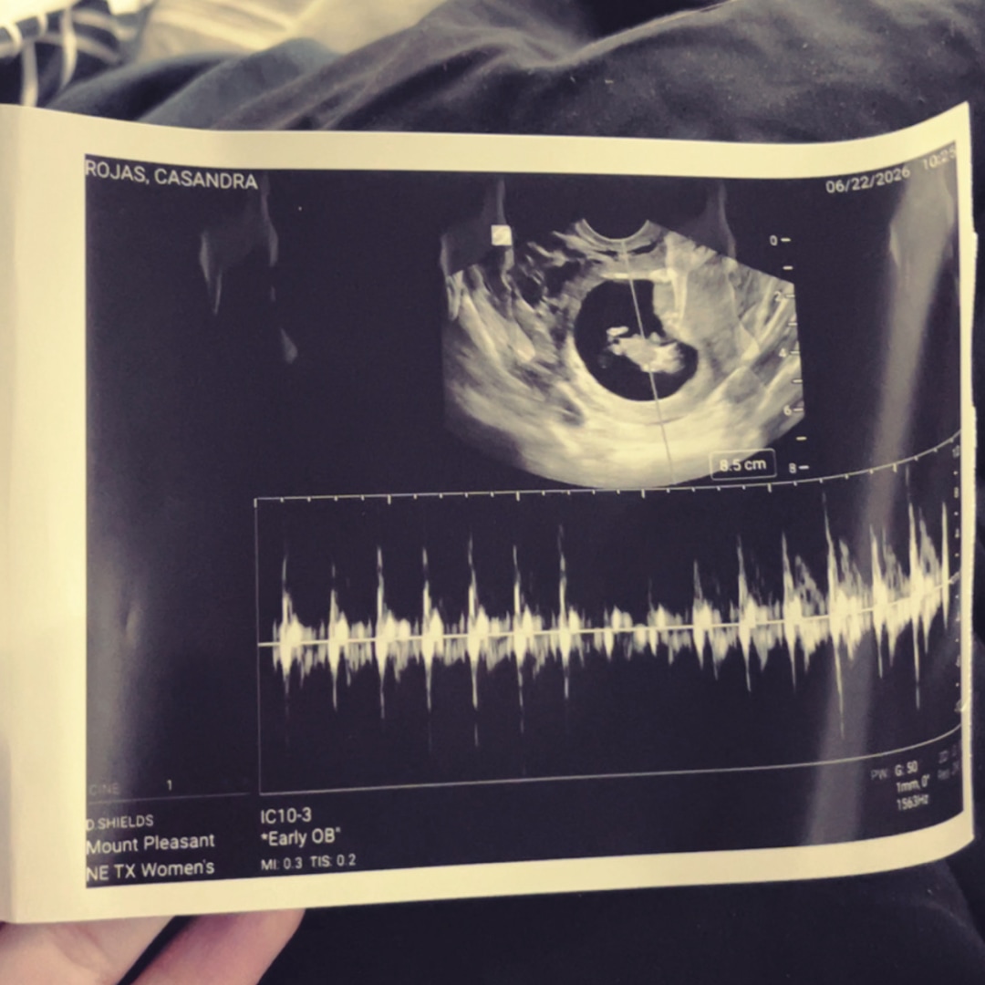 Photo shared by Casandra for their Babylist baby registry.