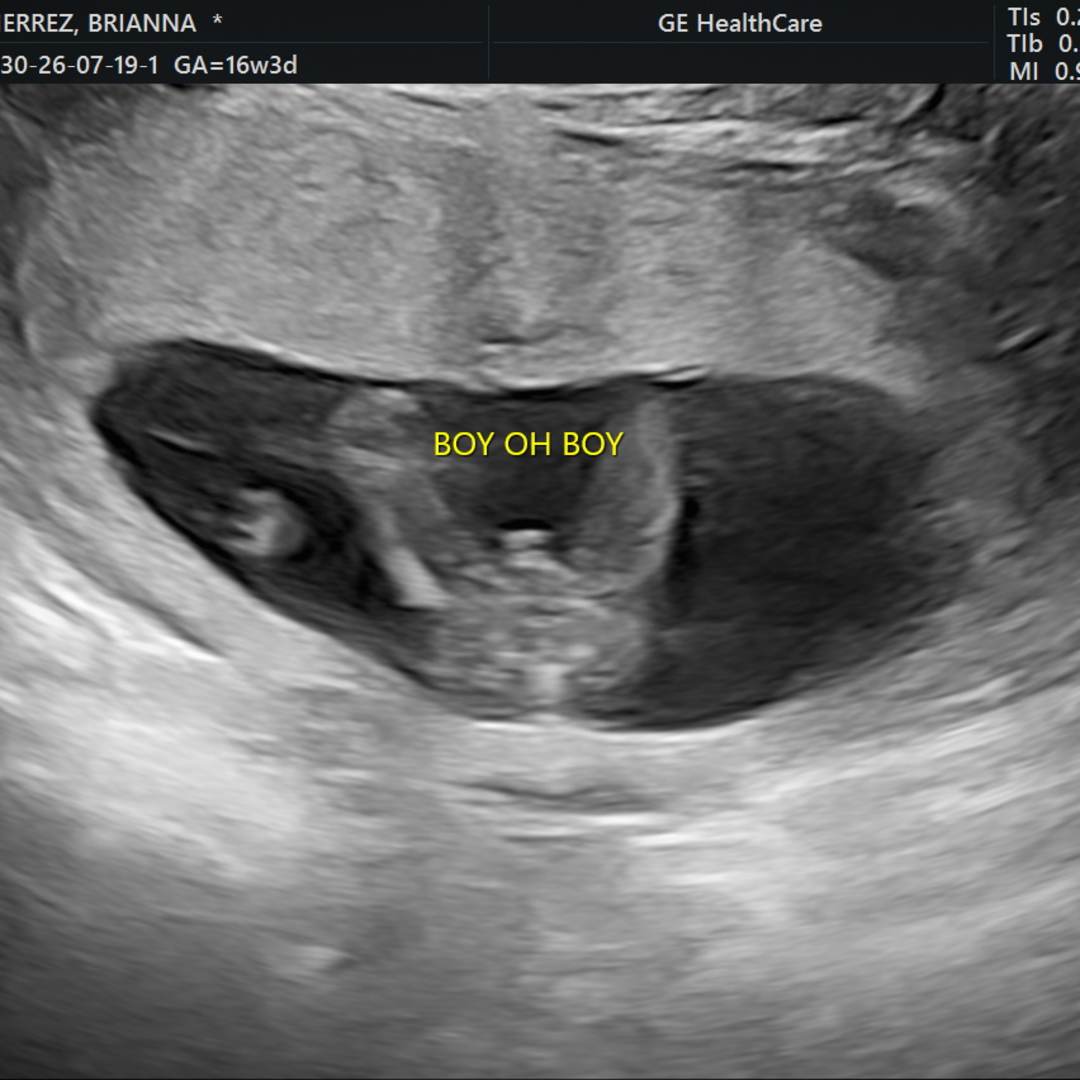 Photo shared by Brianna for their Babylist baby registry.