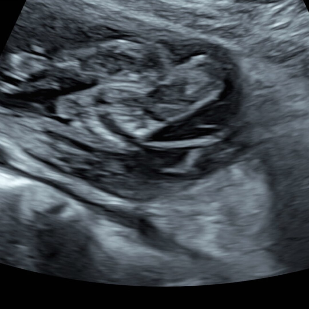 Photo shared by DESTINY for their Babylist baby registry.