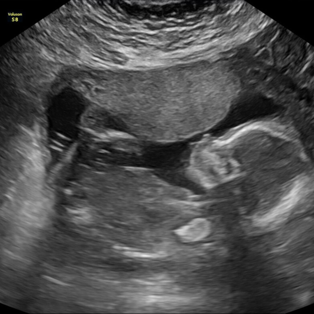 Photo shared by Carrie for their Babylist baby registry.