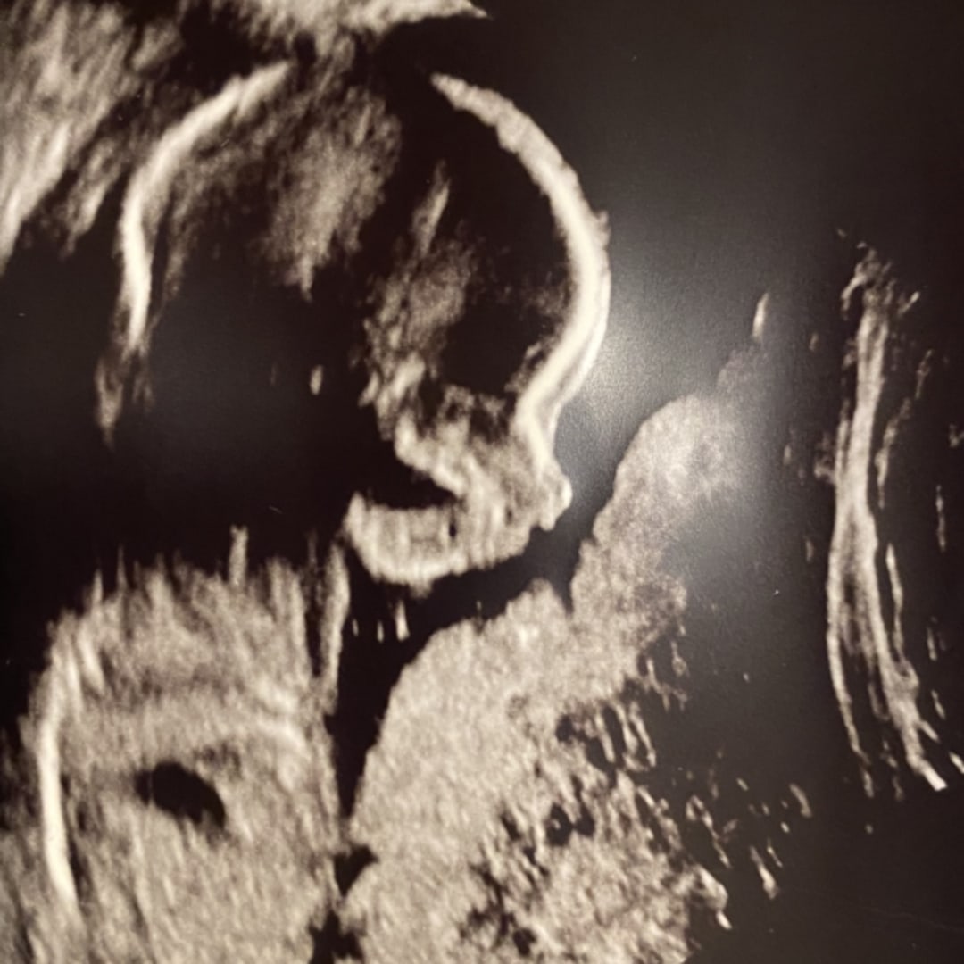 Photo shared by Simone for their Babylist baby registry.