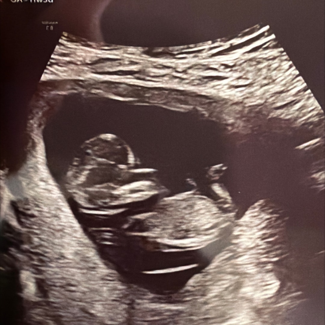 Photo shared by Colin for their Babylist baby registry.