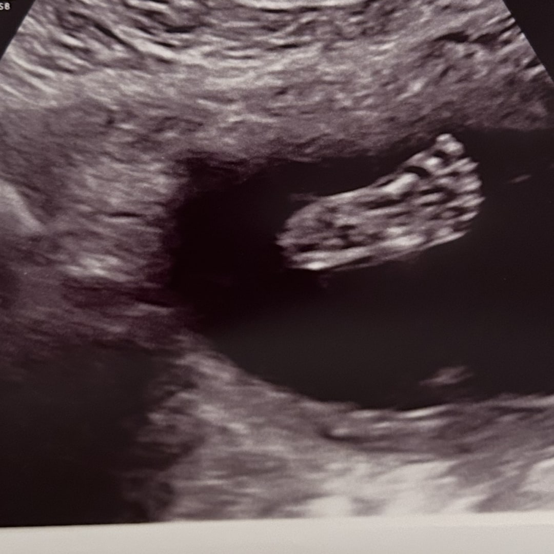 Photo shared by Andrea for their Babylist baby registry.