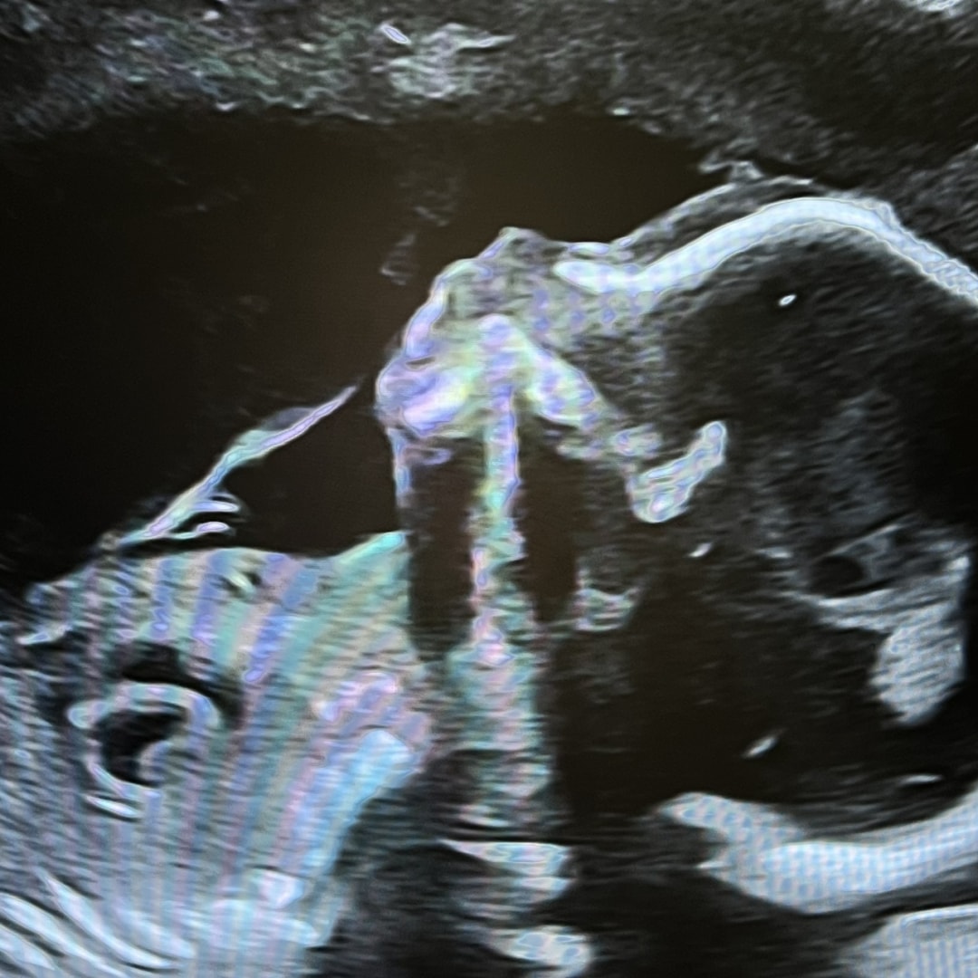 Photo shared by Monica for their Babylist baby registry.