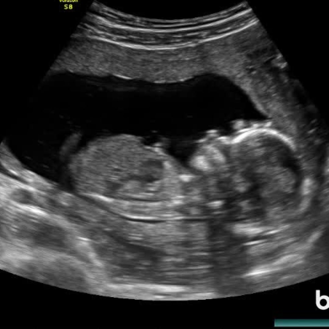 Photo shared by Kierra for their Babylist baby registry.