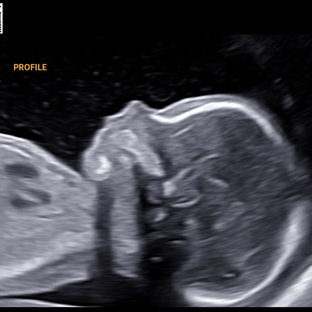 Photo shared by Sam for their Babylist baby registry.