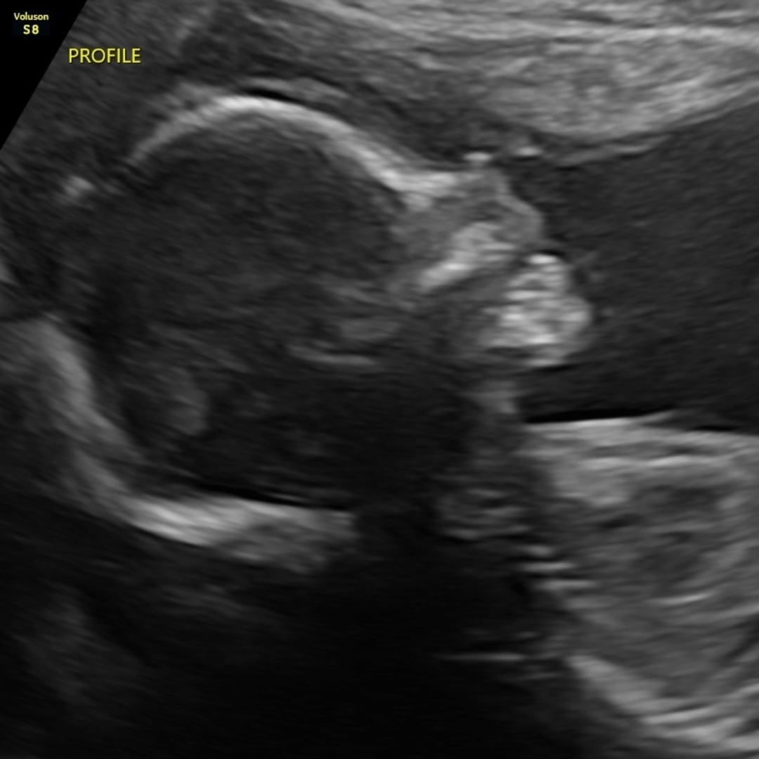 Photo shared by Ellie for their Babylist baby registry.