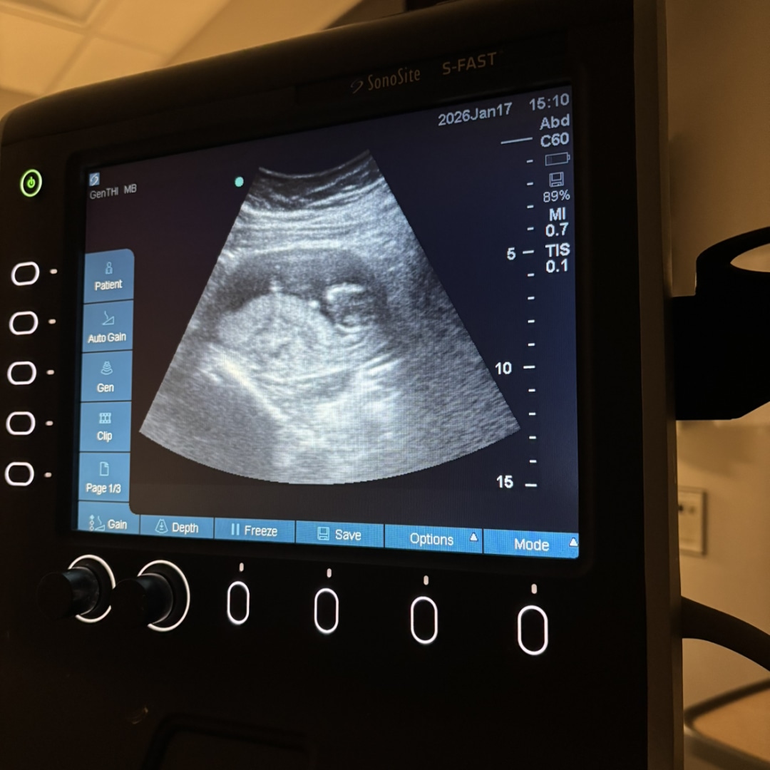 Photo shared by Alyson for their Babylist baby registry.