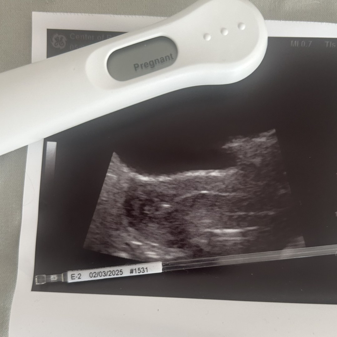 Photo shared by Lauren for their Babylist baby registry.