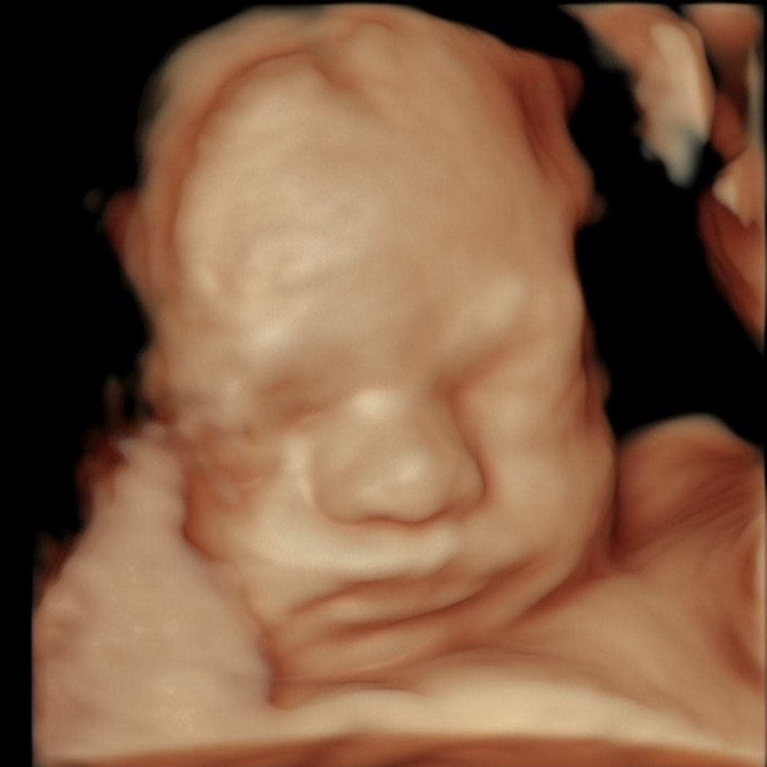 Photo shared by Hannah for their Babylist baby registry.