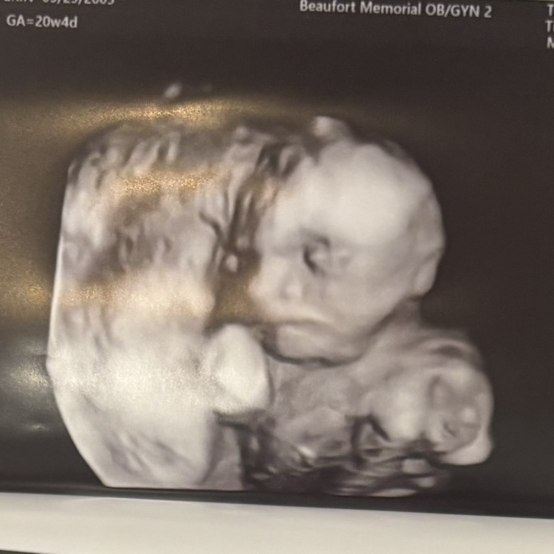 Photo shared by Erin for their Babylist baby registry.