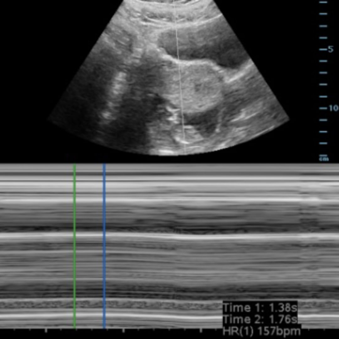 Photo shared by Melissa for their Babylist baby registry.