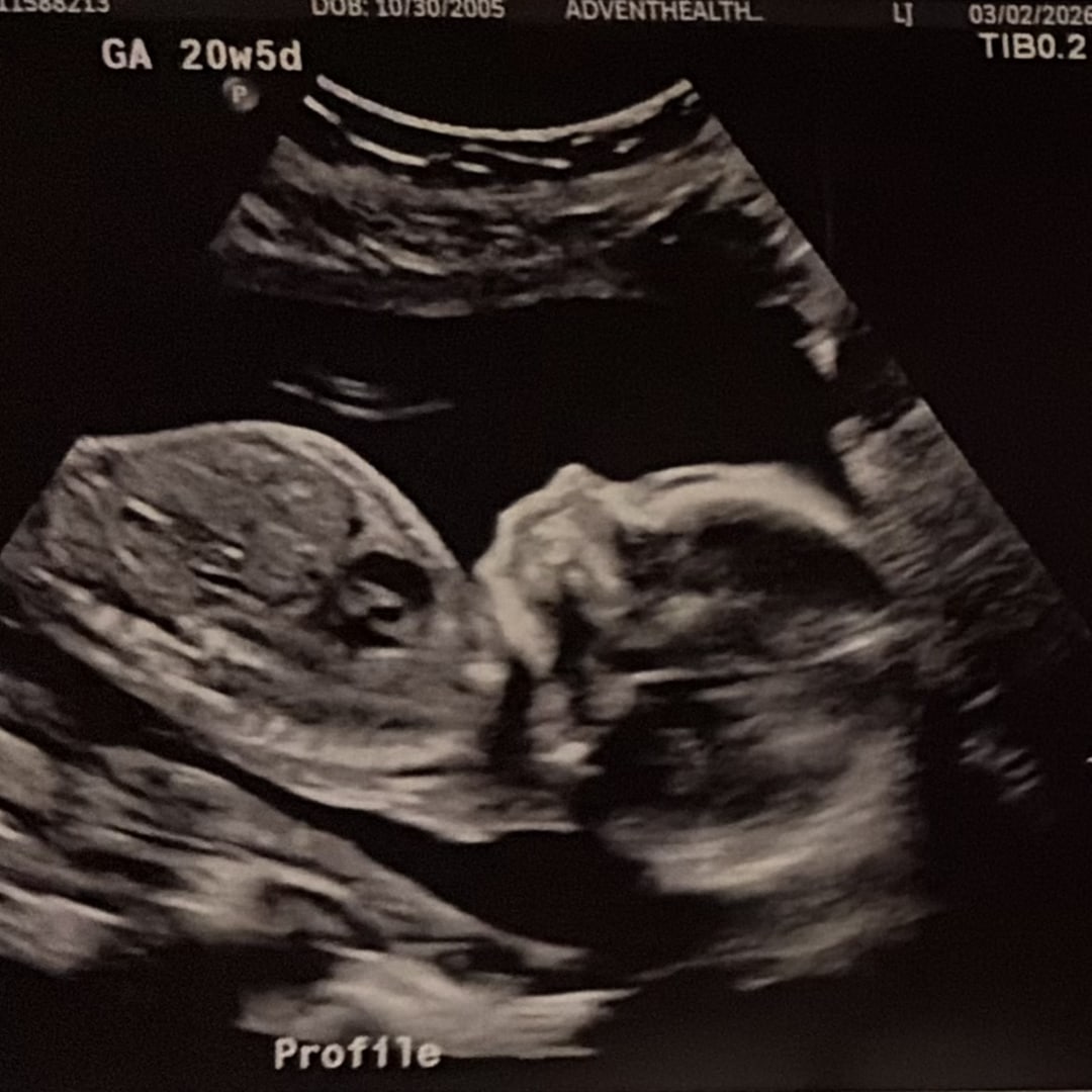 Photo shared by Mady for their Babylist baby registry.